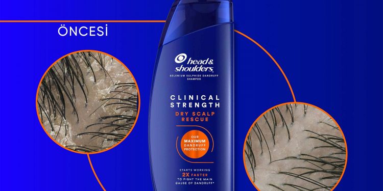 Head & Shoulders’tan kış aylarında klinik güçte koruma
