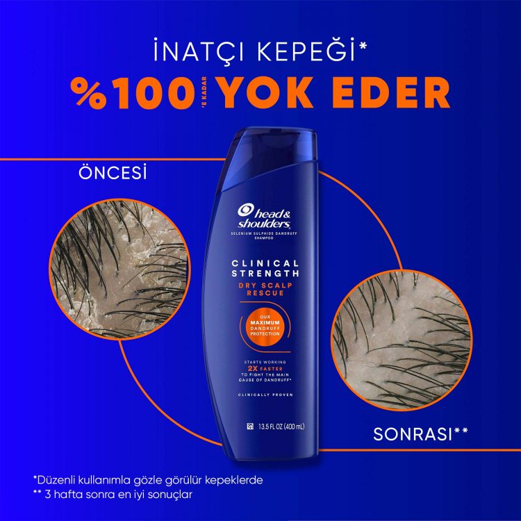 Head & Shoulders’tan kış aylarında klinik güçte koruma